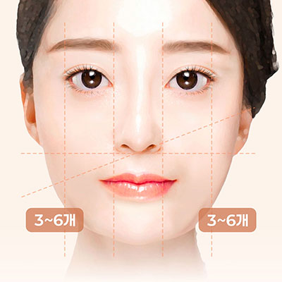 실리프팅단계2개인맞춤