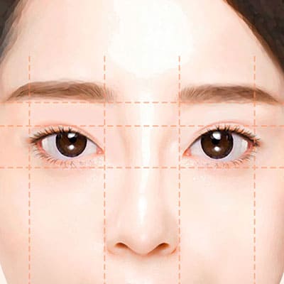 짝눈비대칭쌍꺼풀재수술1진단