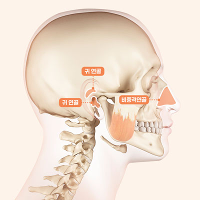 자려한코성형수술방법2